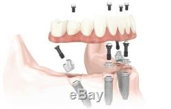 Same day dental all-on-4 implant conversion
